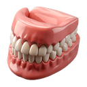 Complete Dentures