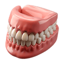 Complete Dentures