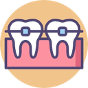 Braces