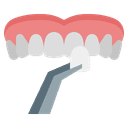 Emax Veneers